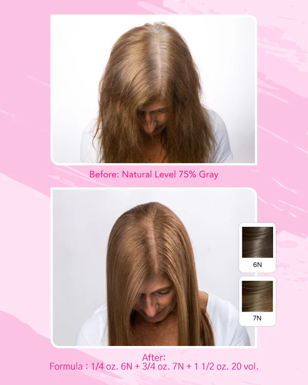 Express Color & Smoothing System Kit - Image 4